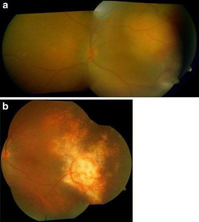 Fig. 3