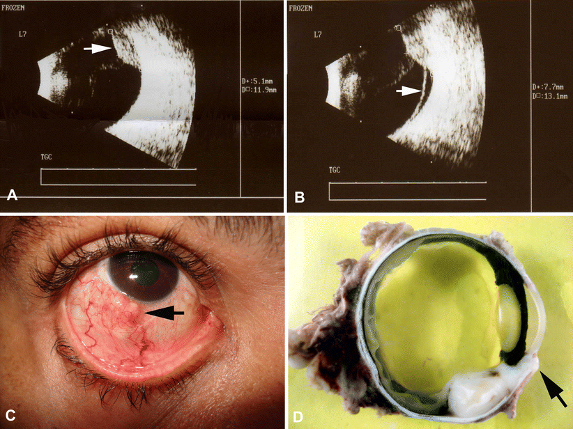 Fig. 1