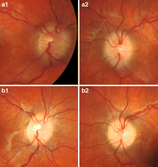 Fig. 3