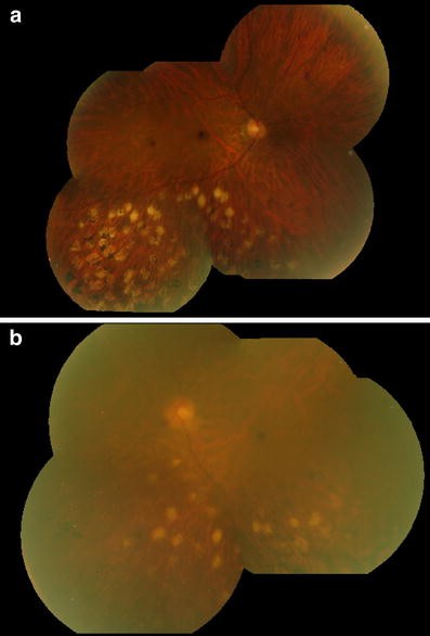 Fig. 3