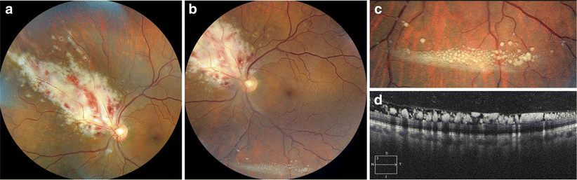 Fig. 1