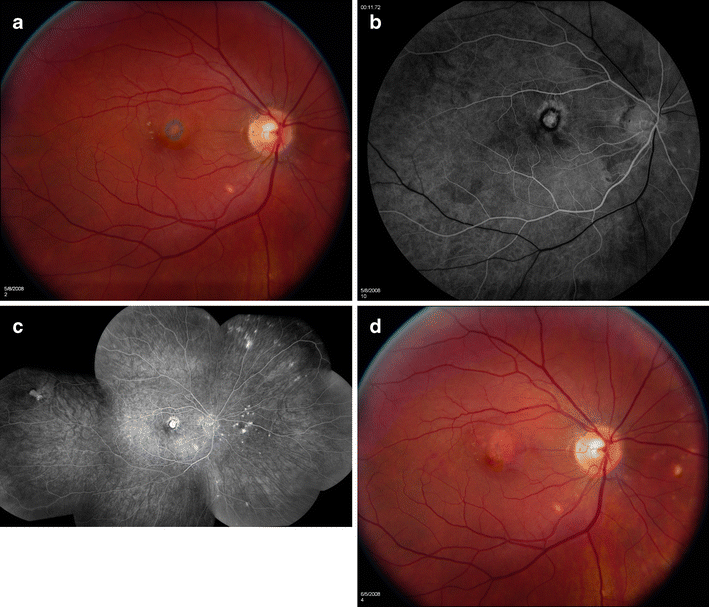 Fig. 1