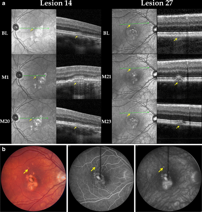 Fig. 2