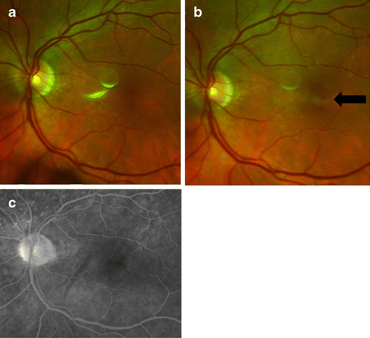 Fig. 1