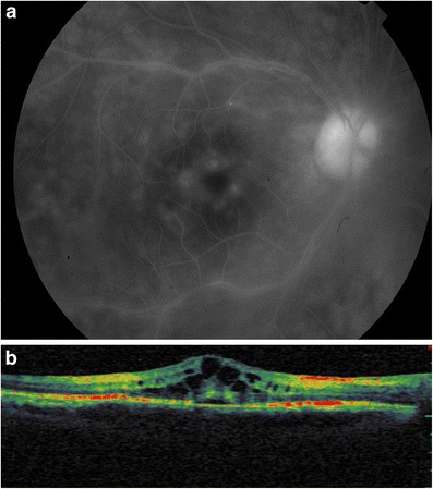 Fig. 1