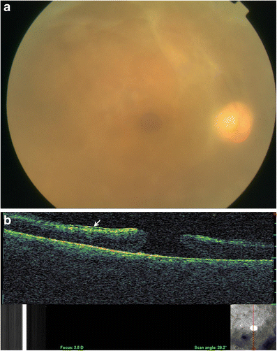 Fig. 2