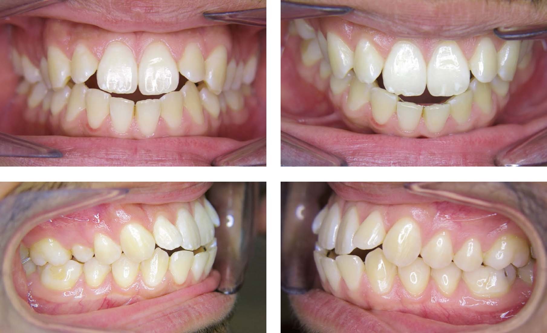 Figure 5 De Ene Open Beet Is De Andere Niet Springerlink