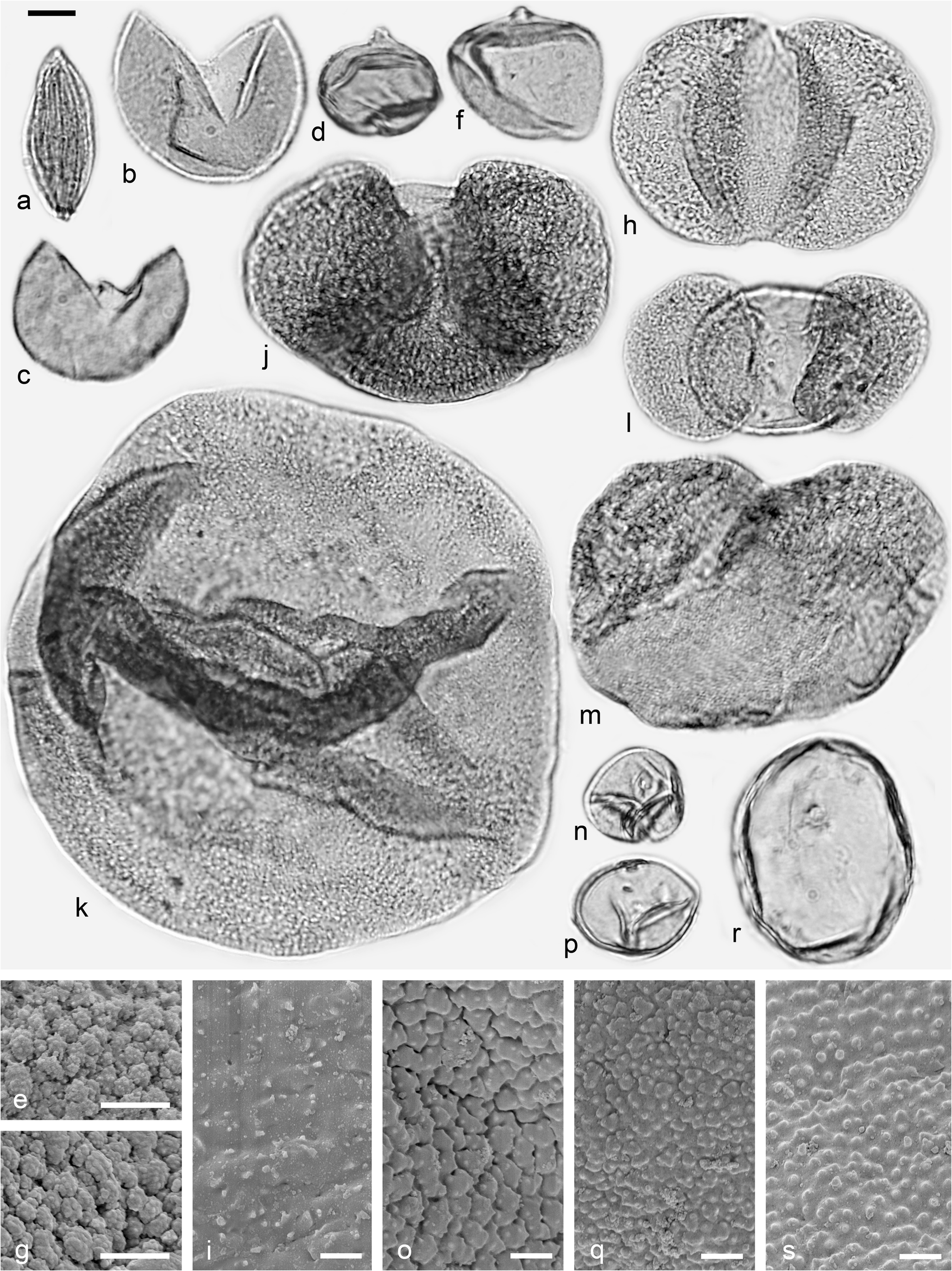 Figure 5 The Middle Miocene Palynofloras Of The Salihpasalar Lignite Mine Yatagan Basin Southwest Anatolia Environmental Characterisation And Comparison With Palynofloras From Adjacent Basins Springerlink
