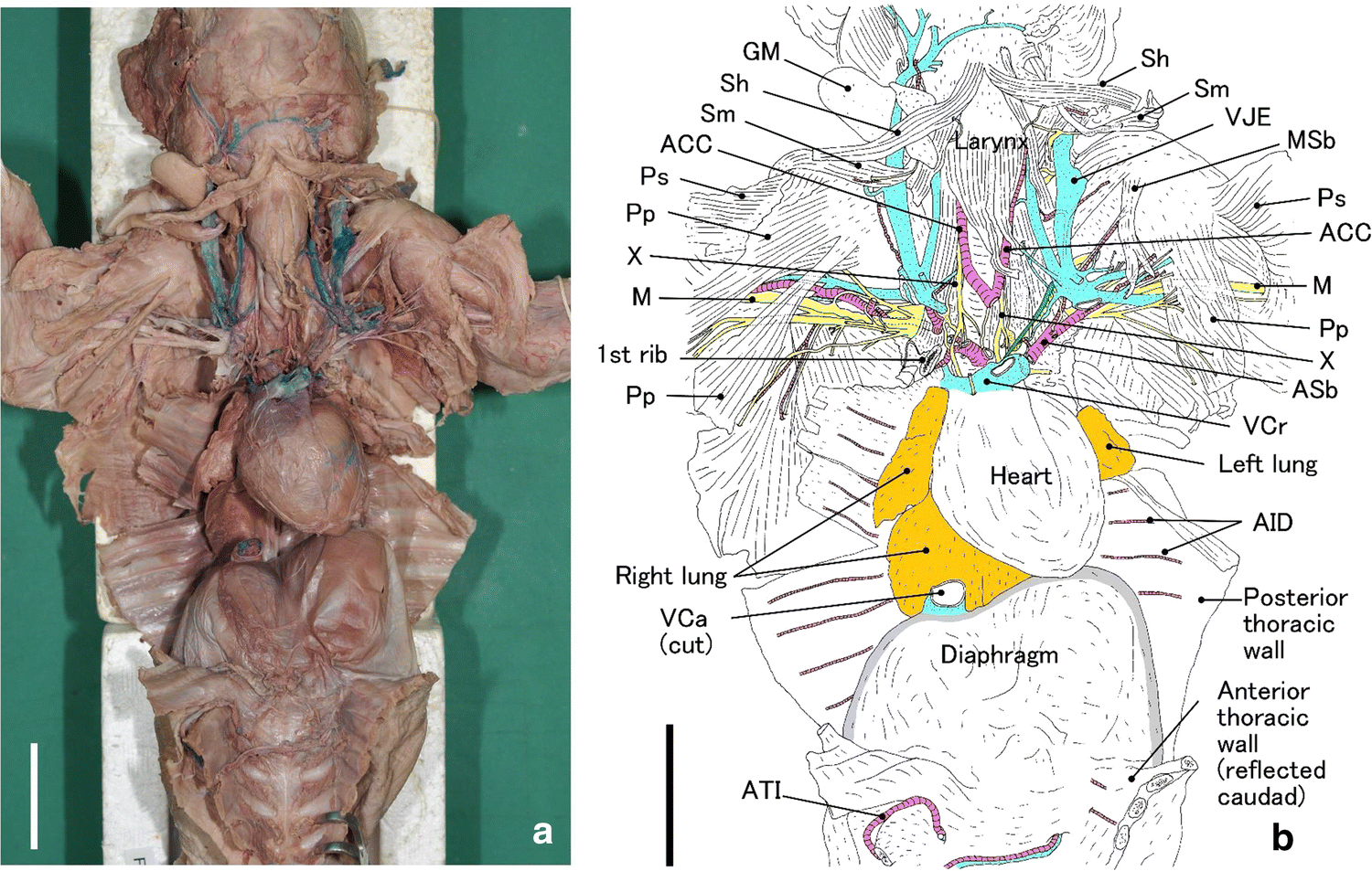 Figure 1 Congenital Diaphragmatic Eventration With Absent Left Phrenic Nerve In The Fetal Pig Springerlink
