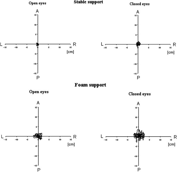 Fig. 2