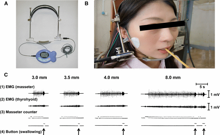 Fig. 2