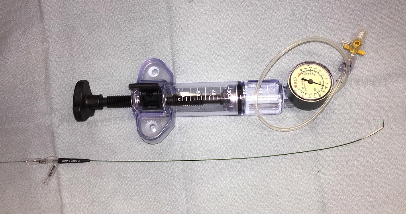 Figure 9 Sialoendoscopy Review And Nuances Of Technique Springerlink