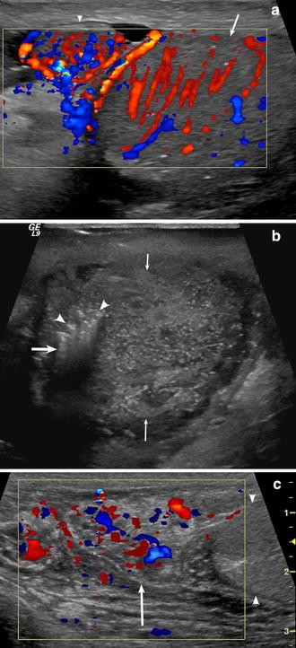 Fig. 3