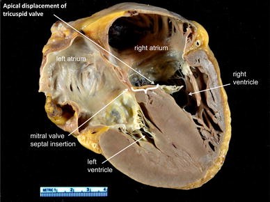 Fig. 5