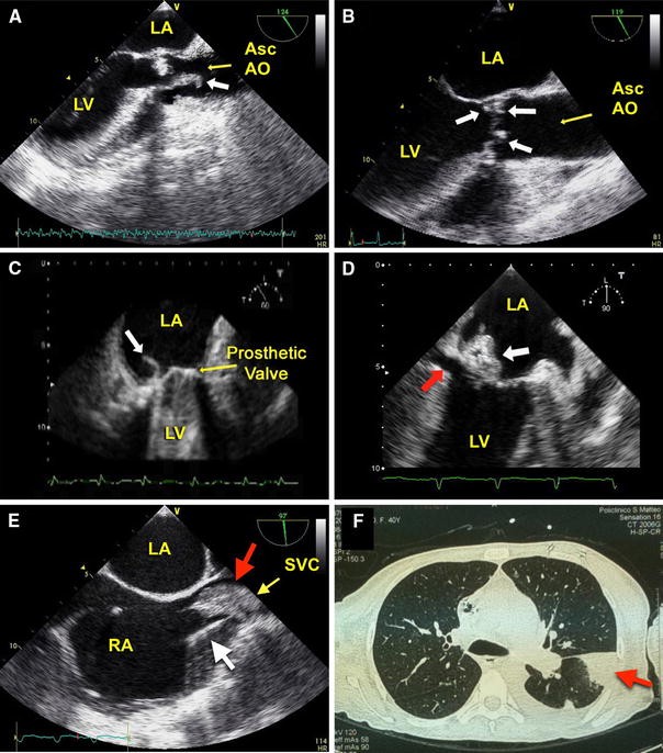 Fig. 9