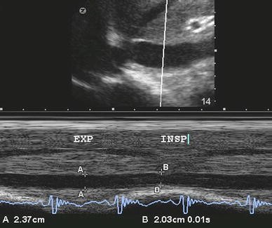 Fig. 10