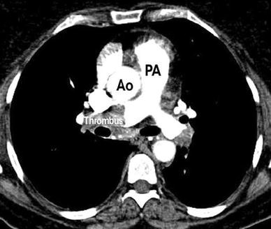 Fig. 13