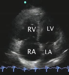 Fig. 4