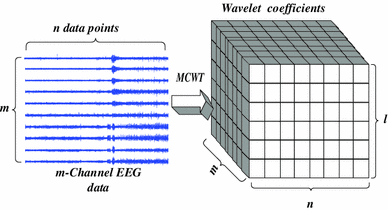 Fig. 1