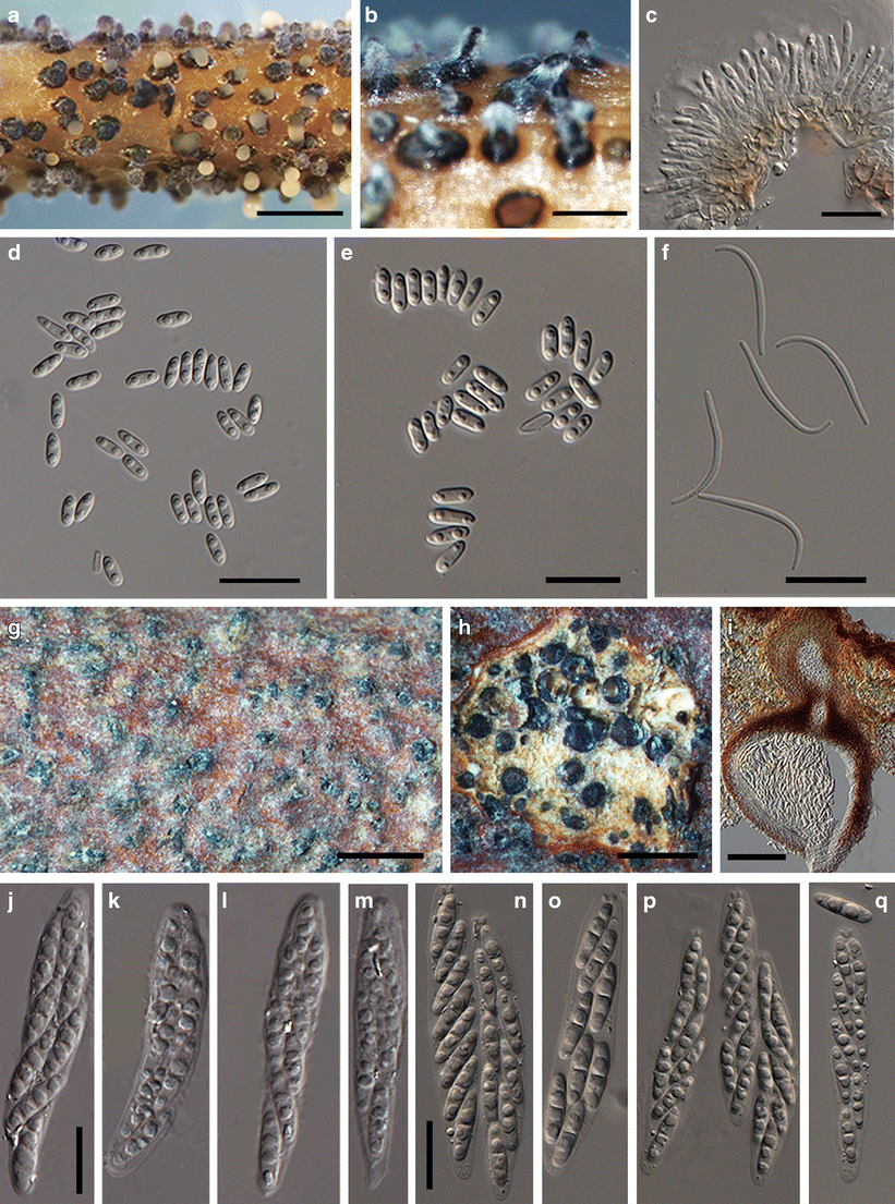 Figure 5 Insights Into The Genus Diaporthe Phylogenetic Species Delimitation In The D Eres Species Complex Springerlink