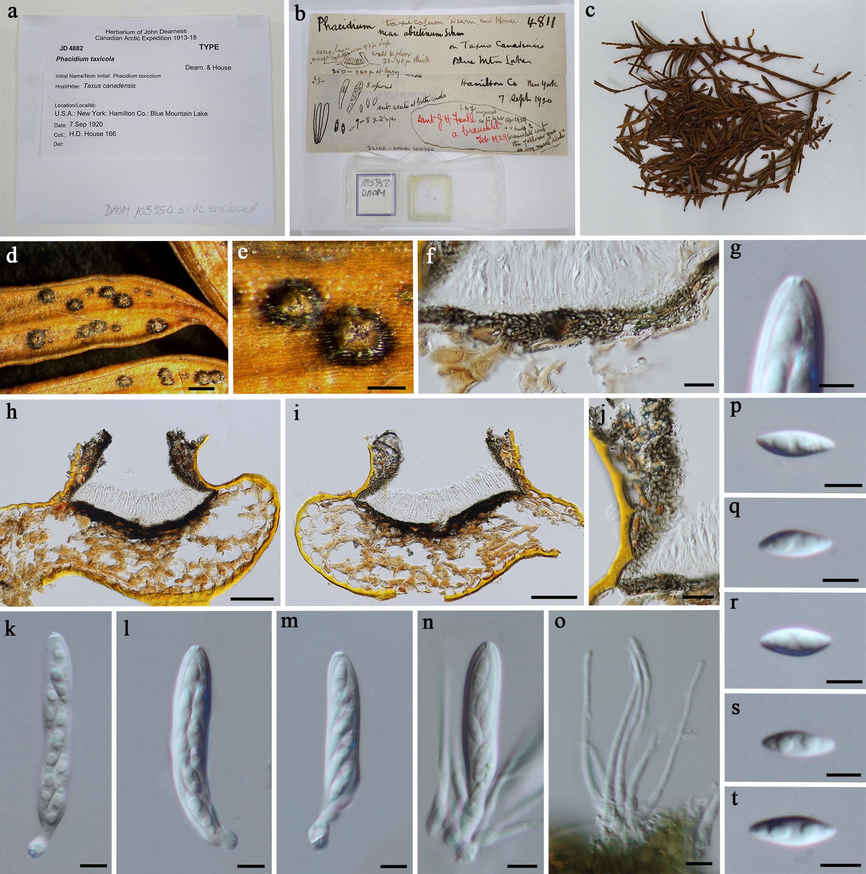 Figure 12 Taxonomy And Phylogeny Of Hyaline Spored Coelomycetes Springerlink