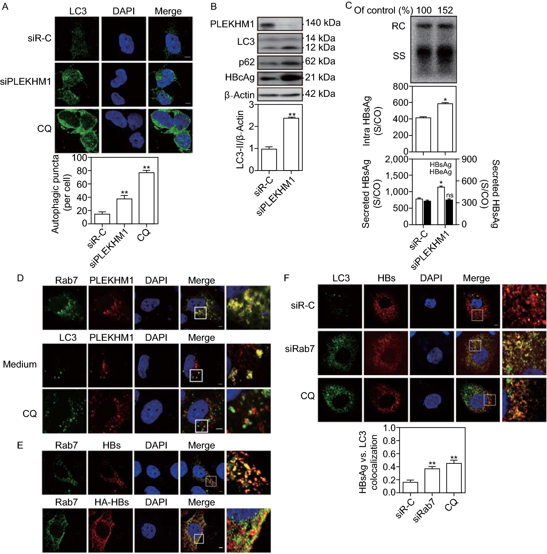 Figure 2 Hepatitis B Virus Is Degraded By Autophagosome Lysosome Fusion Mediated By Rab7 And Related Components Springerlink Figure 2 Hepatitis B Virus Is Degraded By Autophagosome Lysosome Fusion Mediated By Rab7 And Related Components Springerlink