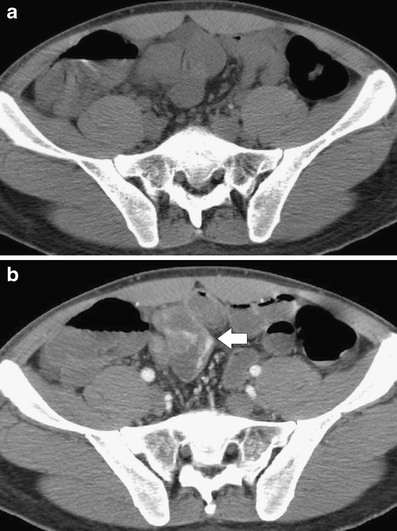 Fig. 8a, b