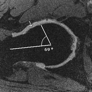 Fig. 11