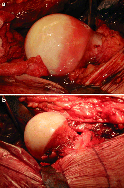 Fig. 12