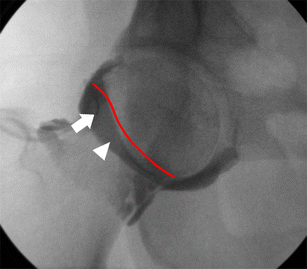 Fig. 1