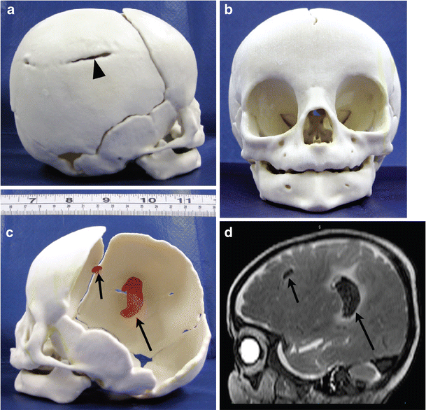 Fig. 3