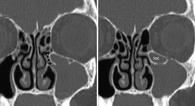 Fig. 11