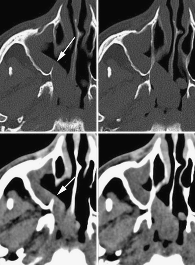 Fig. 16