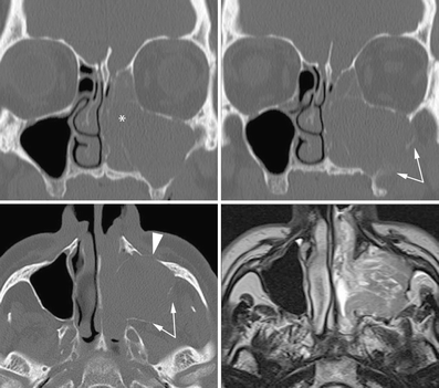 Fig. 20