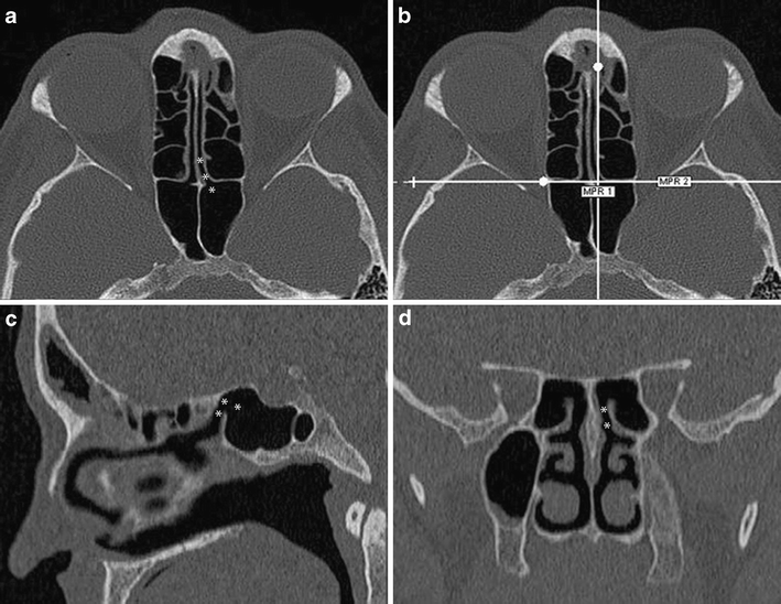 Fig. 4