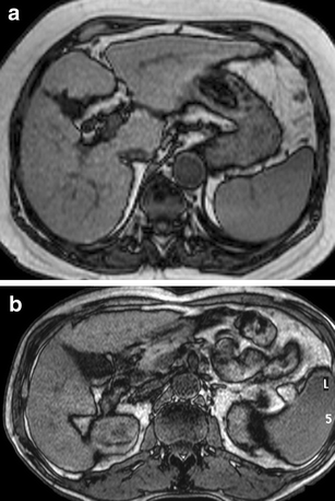 Fig. 1