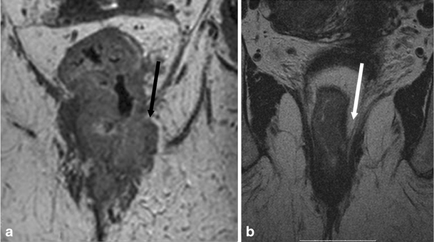 Fig. 11