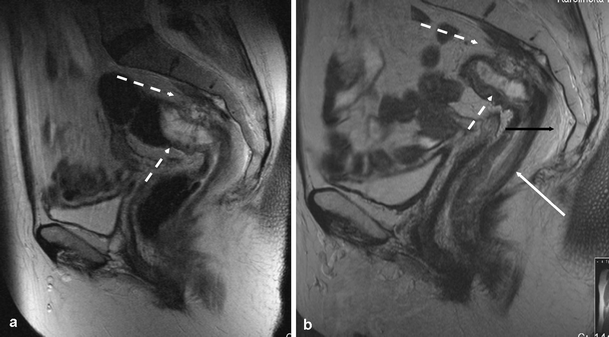 Fig. 15