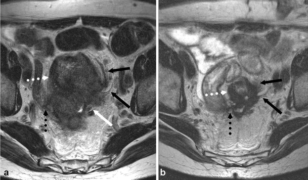 Fig. 17