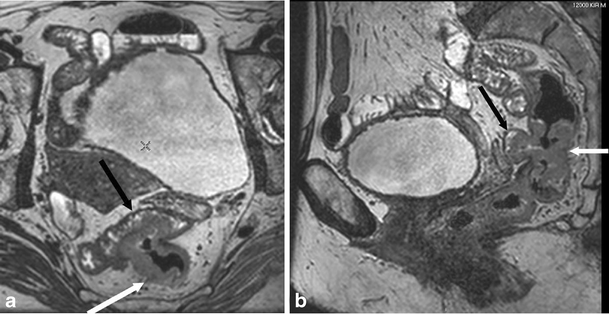 Fig. 6