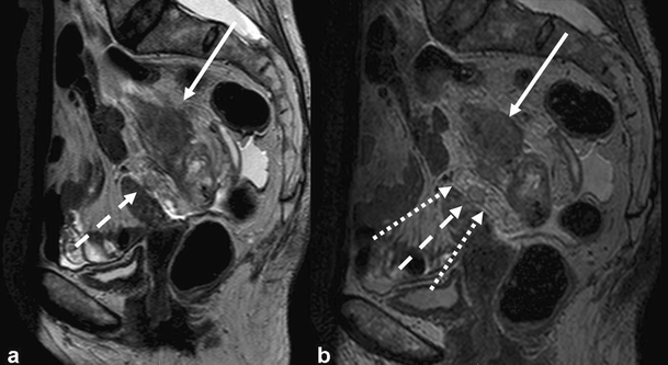 Fig. 9