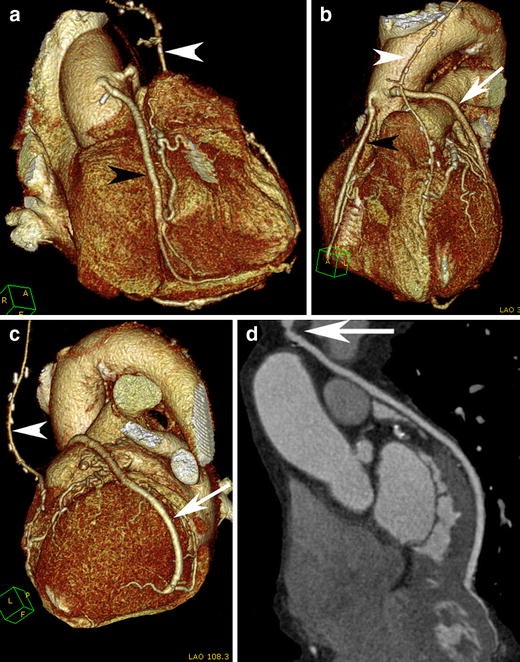 Fig. 10