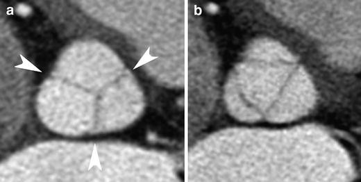 Fig. 14