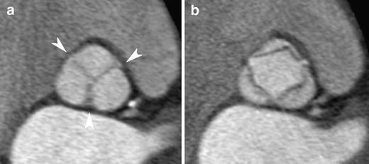 Fig. 15