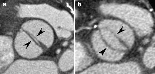 Fig. 16