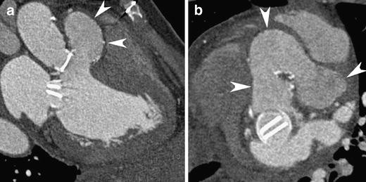 Fig. 18