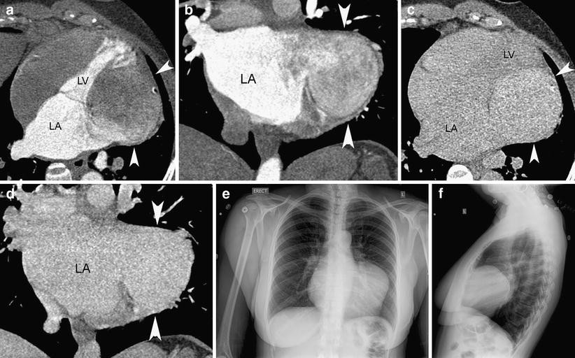 Fig. 20