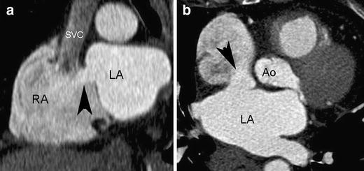 Fig. 22