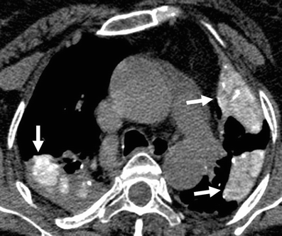 Fig. 11