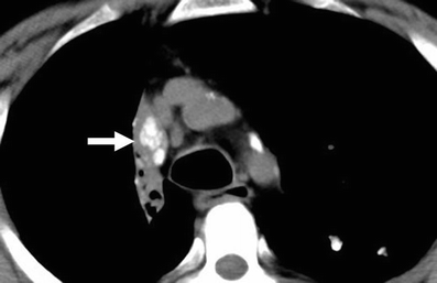 Fig. 15